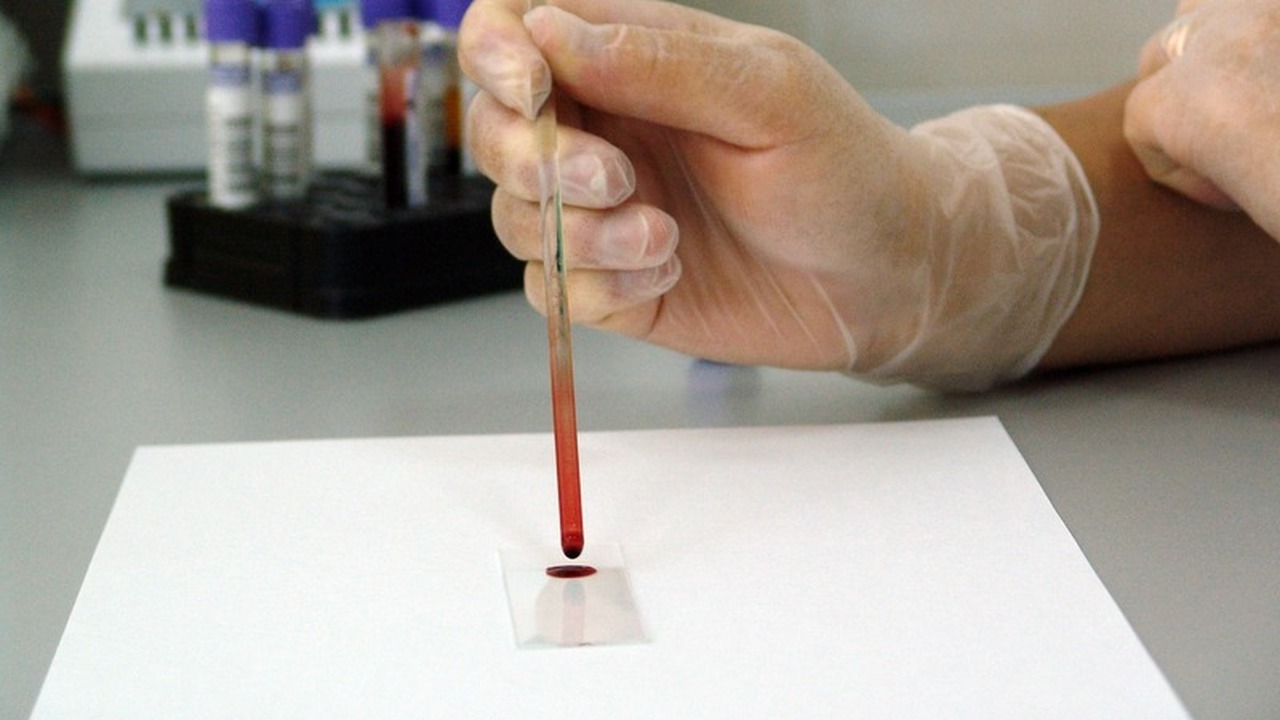 Ученые выявили генетическую связь между группой...